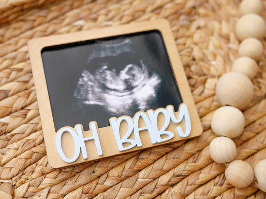 OH Baby Ultrasound photo fridge magnet