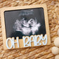 OH Baby Ultrasound photo fridge magnet