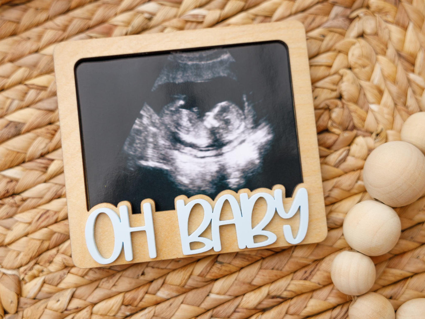 OH Baby Ultrasound photo fridge magnet