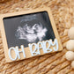 OH Baby Ultrasound photo fridge magnet