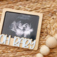 OH Baby Ultrasound photo fridge magnet
